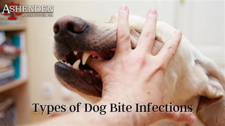 Can a dog bite make you sick?