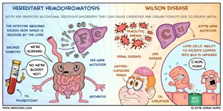 Can hemochromatosis affect the eyes?