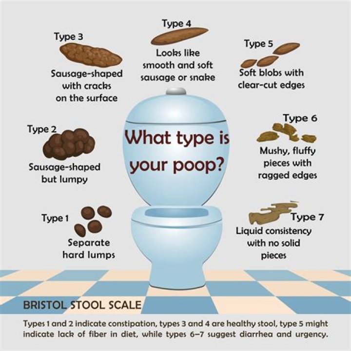 Can I be constipated with soft stool?