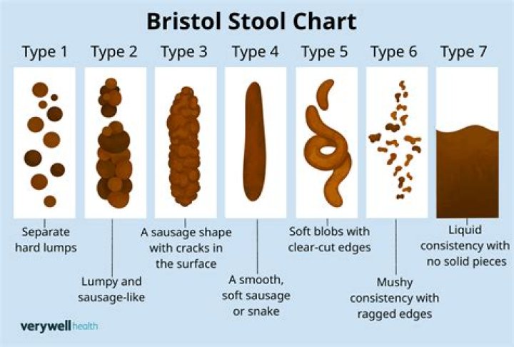Can IBS cause pale stool?