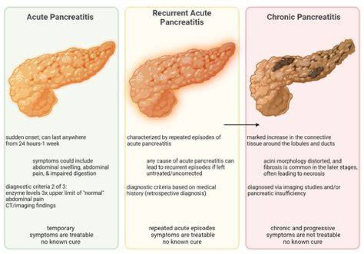 Can you have pancreatitis for years without knowing?