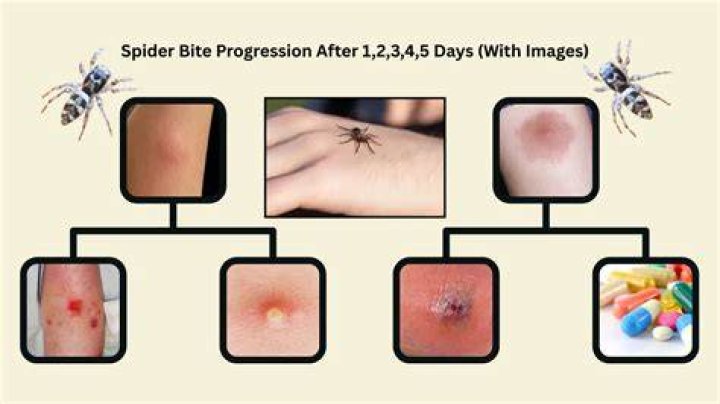 Do clock spiders bite?