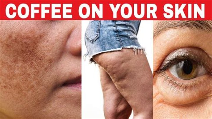 Does coffee make your skin glow?