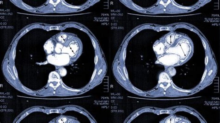 How much is a CT heart scan?