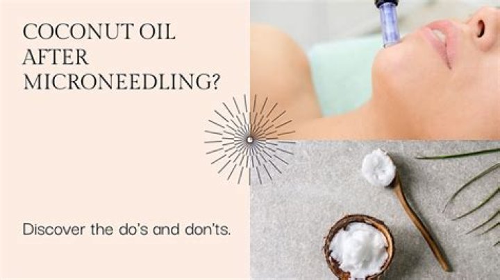 Is coconut oil OK to use after microneedling?