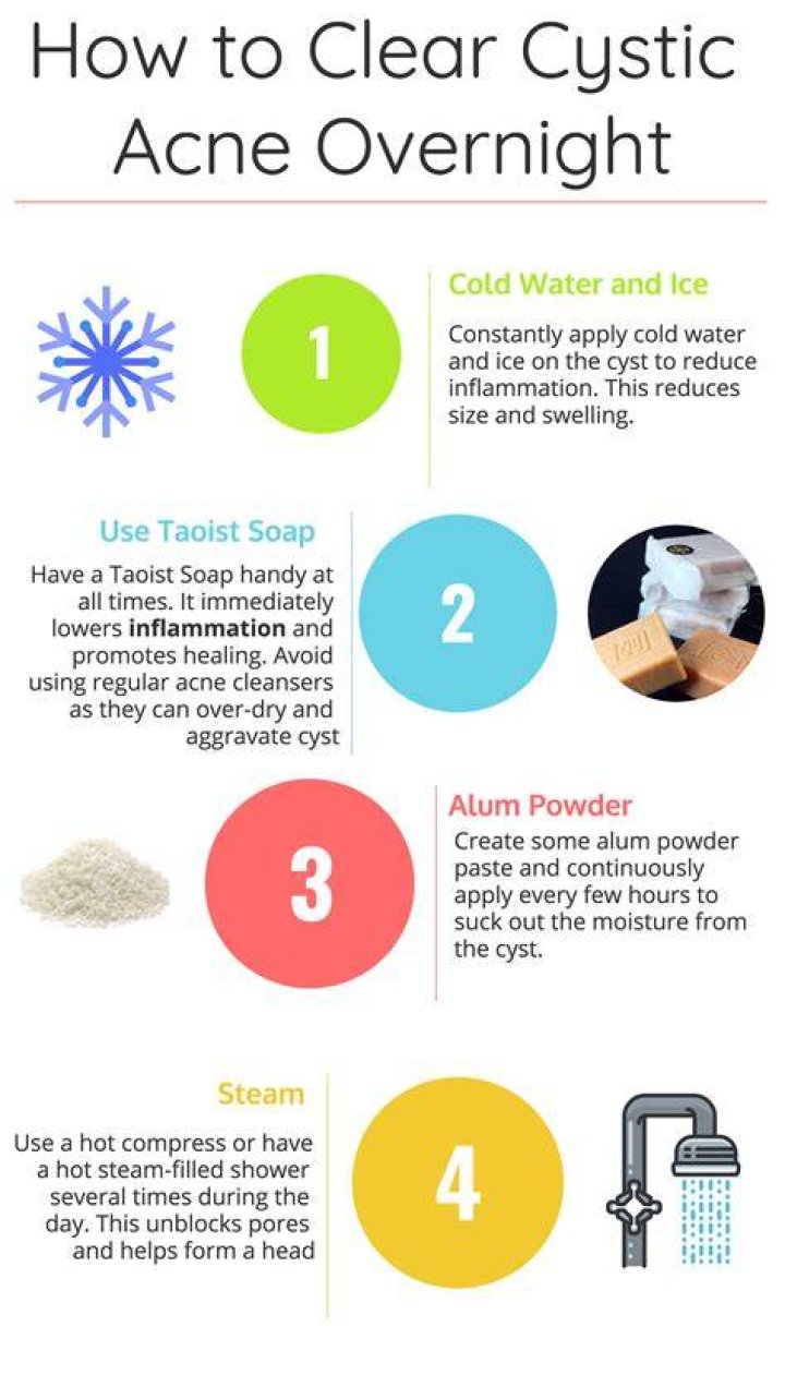 Is it better to ice or heat cystic acne?