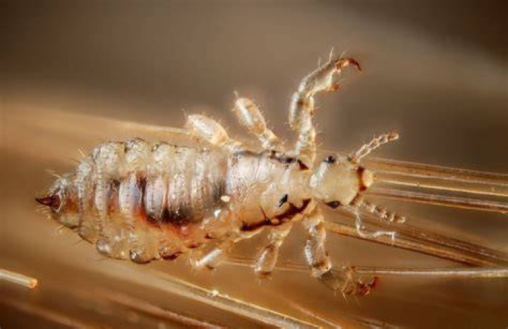 What can be mistaken for head lice?