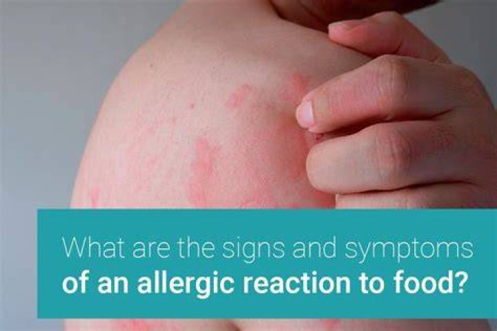 What does a food allergy skin rash look like?