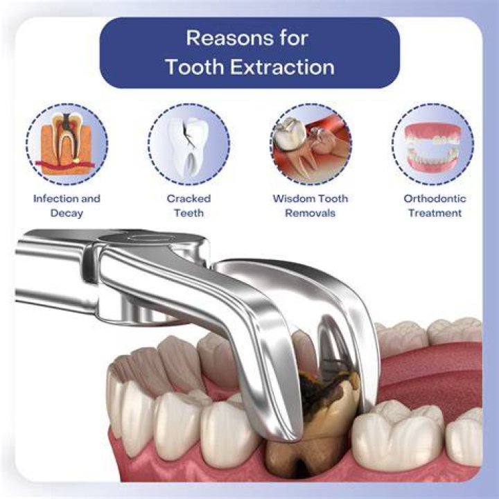 What drug is used for tooth extraction?