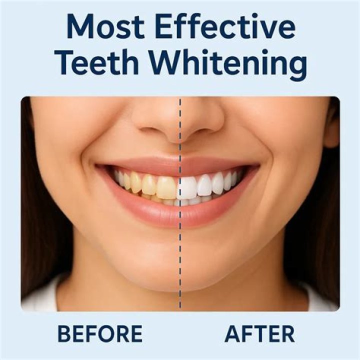 What is the most effective whitening ingredient?