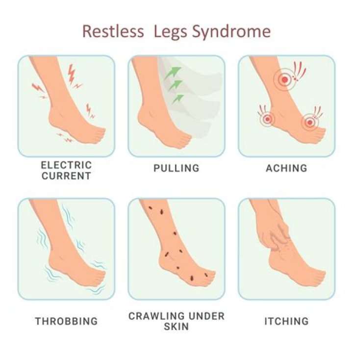 What mimics restless leg syndrome?