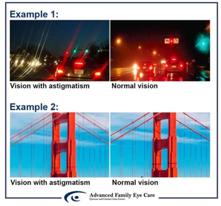 What people see when they have astigmatism?