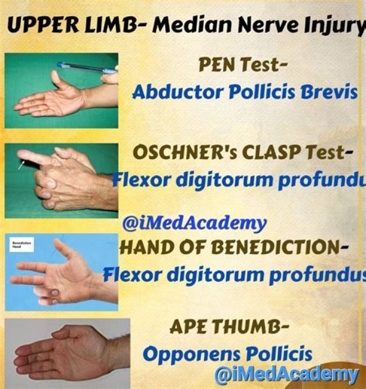 What test determines median nerve injury?