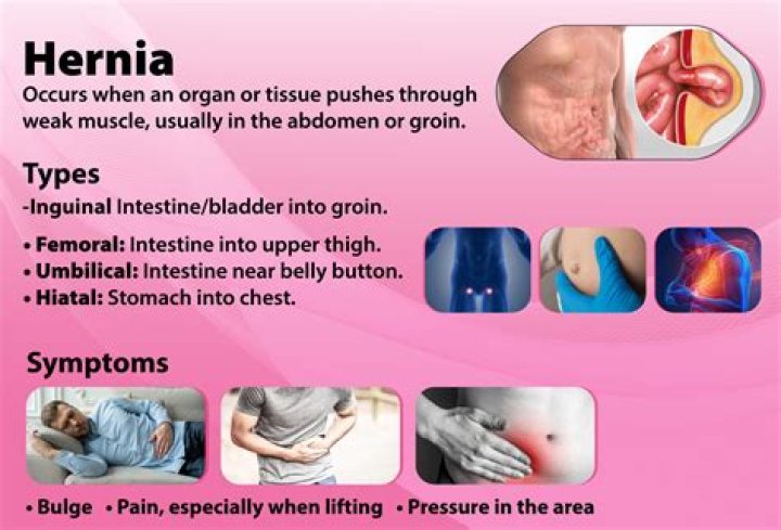 Why does my hernia make a gurgling sound?